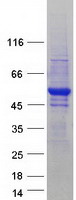 Coomassie blue staining of purified CSTF1 protein