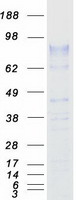 protq05996 zp2 human recombinant protein