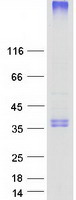Coomassie blue staining of purified KDSR protein