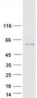 Coomassie blue staining of purified RBPJ protein