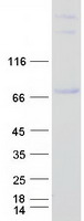 Coomassie blue staining of purified RUNX1T1 protein