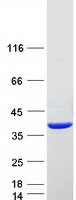 protq06520 sult2a1 human recombinant protein