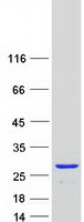Coomassie blue staining of purified PRDX1 protein