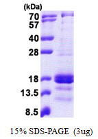 3ug by SDS-PAGE under reducing condition and visualized by coomassie blue stain