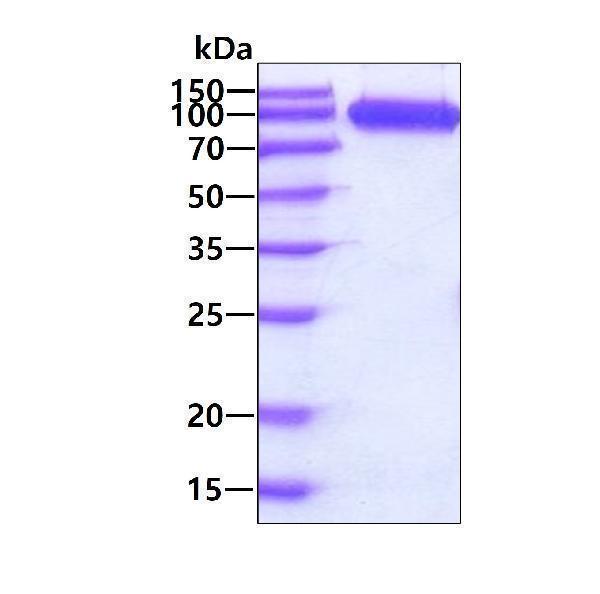 3ug by SDS-PAGE under reducing condition and visualized by coomassie blue stain