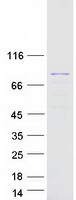 protq0vak6 leiomodin 3 lmod3 human recombinant protein