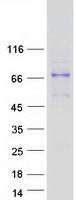 protq10472 galnt1 human recombinant protein