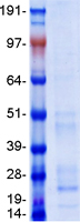Coomassie blue staining of purified BST2 protein