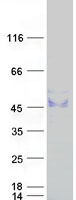Coomassie blue staining of purified ST3GAL1 protein