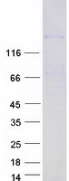 Coomassie blue staining of purified HMGXB3 protein