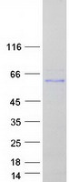 Coomassie blue staining of purified EFEMP1 protein
