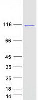 Coomassie blue staining of purified BFSP1 protein