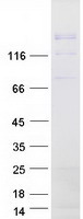 protq13009 tiam1 human recombinant protein