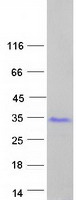 Coomassie blue staining of purified GAGE2B protein