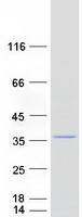Coomassie blue staining of purified MRPL28 protein