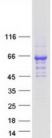 protq13098 csn1 gps1 human recombinant protein