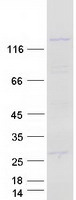 protq13136 liprin alpha 1 ppfia1 human recombinant protein