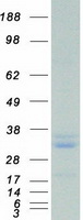 Coomassie blue staining of purified PRDX4 protein