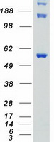 Coomassie blue staining of purified STK3 protein