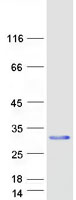 protq13241 cd94 klrd1 human recombinant protein