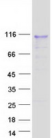 protq13316 dmp1 human recombinant protein