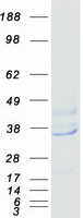 protq13347 eif3s2 eif3i human recombinant protein