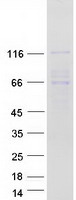 protq13370 pde3b human recombinant protein