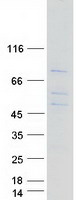 protq13416 orc2 human recombinant protein