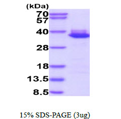 3ug by SDS-PAGE under reducing condition and visualized by coomassie blue stain.