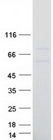 Coomassie blue staining of purified BIRC3 protein