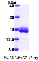 protq13542 sdspage human eif4ebp2 recombinant protein