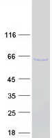 protq13568 irf5 human recombinant protein