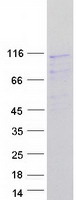 protq13608 pex6 human recombinant protein