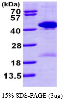 3ug by SDS-PAGE under reducing condition and visualized by coomassie blue stain