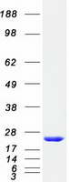 protq13636 rab31 human recombinant protein