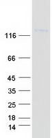 Coomassie blue staining of purified ITGA9 protein