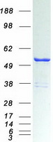 Coomassie blue staining of purified DDX39B protein