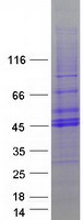 Coomassie blue staining of purified TOB2 protein