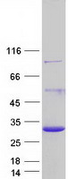 Coomassie blue staining of purified DGCR6 protein