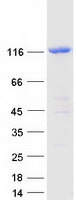 Coomassie blue staining of purified UBE4A protein
