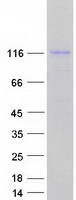 Coomassie blue staining of purified DHX34 protein