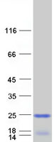 Coomassie blue staining of purified MRPL58 protein