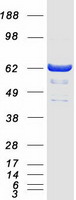 Coomassie blue staining of purified GCKR protein