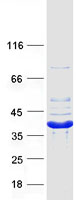 Coomassie blue staining of purified CRYM protein