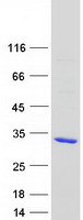 protq14964 rab39 rab39a human recombinant protein