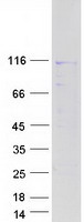 protq14cx7 nap1 naa25 human recombinant protein