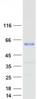 Coomassie blue staining of purified WTAP protein