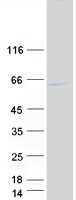Coomassie blue staining of purified HERPUD1 protein