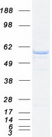 Coomassie blue staining of purified PPP2R5B protein