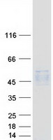 Coomassie blue staining of purified PSG5 protein
